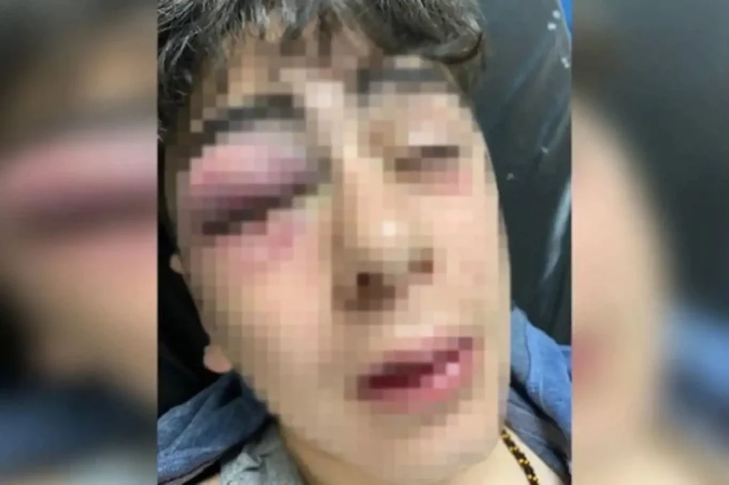 Diyarbakır’da 14 Yaşındaki Çocuğa İşkence İddiası